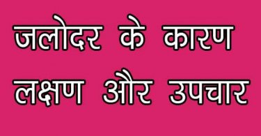 जलोदर रोग क्या है इसके कारण, लक्षण और उपचार हिंदी में, jalodar rog ke karan lakshan aur upchar hindi mein jane