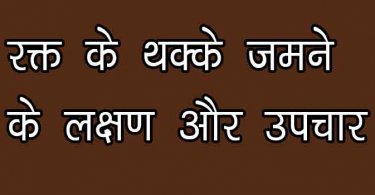 रक्त के थक्के जमने के कारण और उपचार जाने विस्तार से हिंदी में, rakt ke thakke jmne ke karan aur upchar in hindi