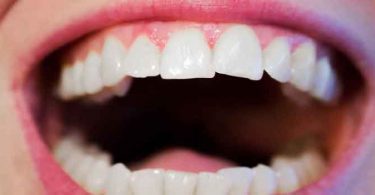 जाने मसूड़ों को मजबूत और मजबूत रखने के लिए कुछ उपाय और आहार ताकि आप कर सकें दांतों की देखभाल, gums diet tips in hindi so you can care them by home remedies