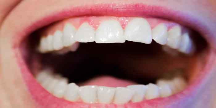 विस्तार में जाने मसूड़ों को स्वस्थ और मजबूत रखने के कारगर तरीके ताकि आप कर सकें आयुर्वेदिक घरेलू उपाय से दांतो की देखभाल, gum health tips in hindi