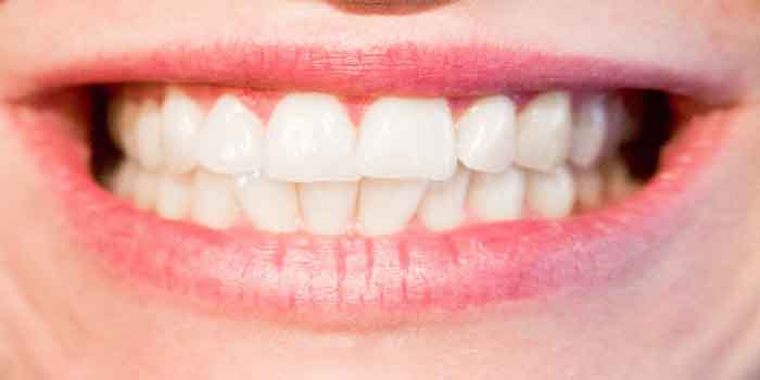डायस्टेमा : दांतों के बीच गैप क्या है – कारण और उपचार और क्या हैं इसके कारण और उपचार जाने दातों की देखभाल बेहतर तरीके से करने के लिए