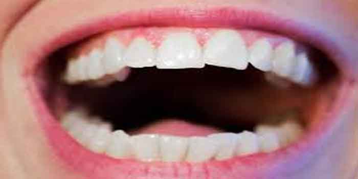 दांत दर्द का आयुर्वेदिक इलाज