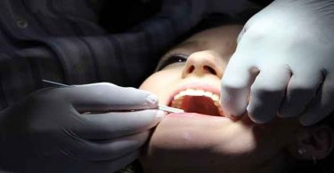 दांतों की 5 बीमारियां और समाधान