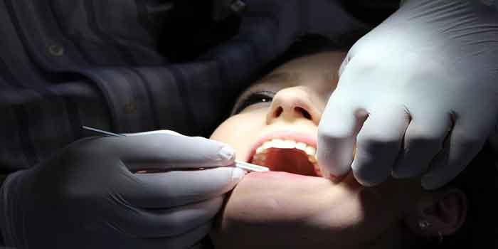 दांत उखाड़ने के बाद क्या करना चाहिए