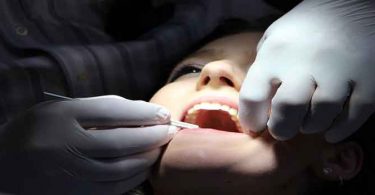 दांतों से खून आना – घरेलू उपाय