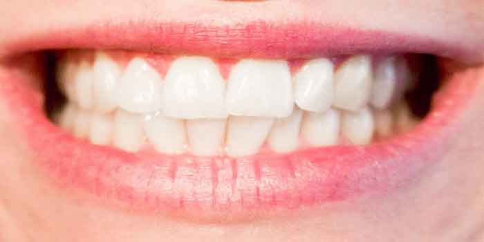 दांतों का पीलापन दूर करने के लिए सरसों के तेल का पेस्ट